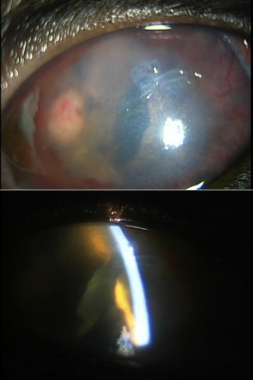 眼球内腫瘍により前眼房が浅くなっており、虹彩も不正である。