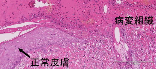 組織所見高倍率