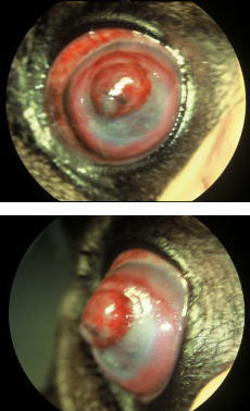 角膜融解とデスメ瘤形成を伴う前眼球炎