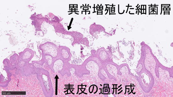 皮膚組織検査所見